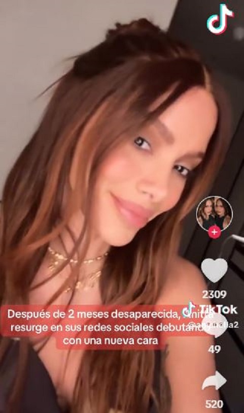 Anitta estrena ‘nuevo rostro’; a través de sus redes sociales se le pudo ver con un drástico cambio físico