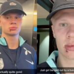 Haaland sufre accidente en autobus y comparte su herida con tres puntos de sutura