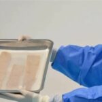 Banco de Tejidos del Edomex dona tejido amniótico para pacientes quemados en Iztapalapa